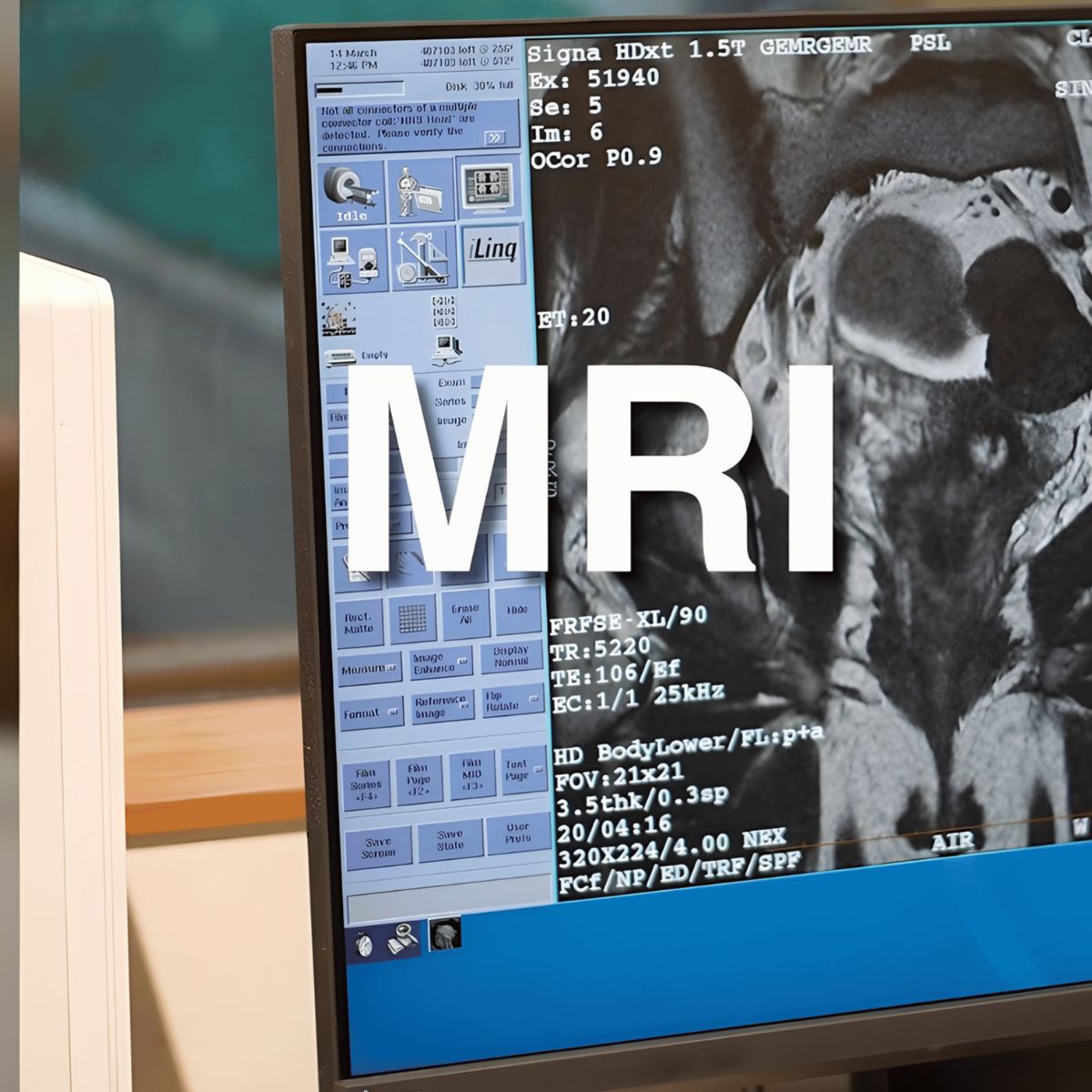 MRI Scan Results